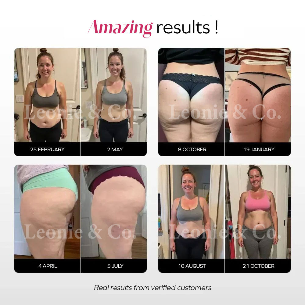 Leonie & Co - Innovative Anti-Cellulite Leggings
