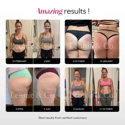 Innovative Anti-Cellulite Leggings
